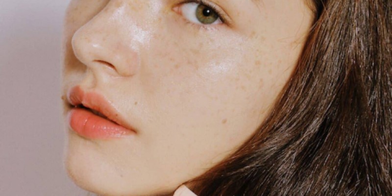 Săc tố Melanin và nguyên nhân gây ra tình trạng nám da?